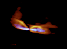 ALMA view of jets and outflows from a newborn star